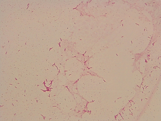 Bacillus Slides - Bacillus 06 1000X